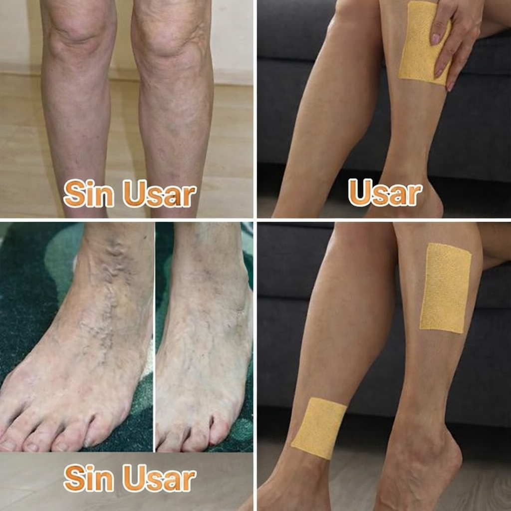 3x1 Parches Naturales para Varices y para las Piernas Cansadas - VeinPatch™