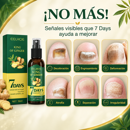 7 Days - Aceite Anti Hongos en Uñas