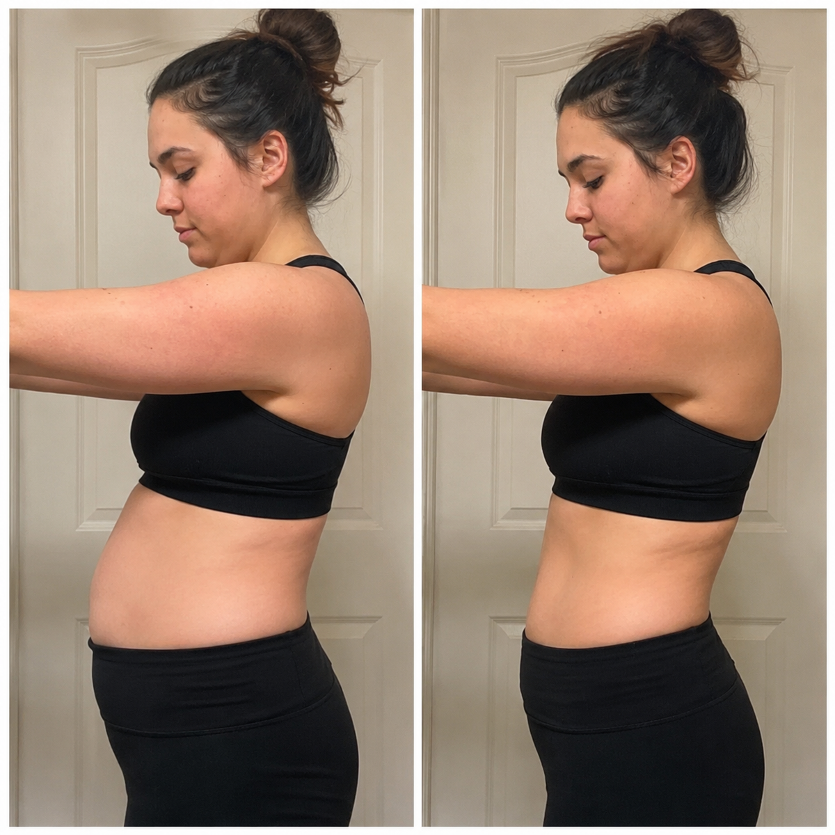 Linfovit™ – Soporte Metabolito Contra Líquidos Retenidos