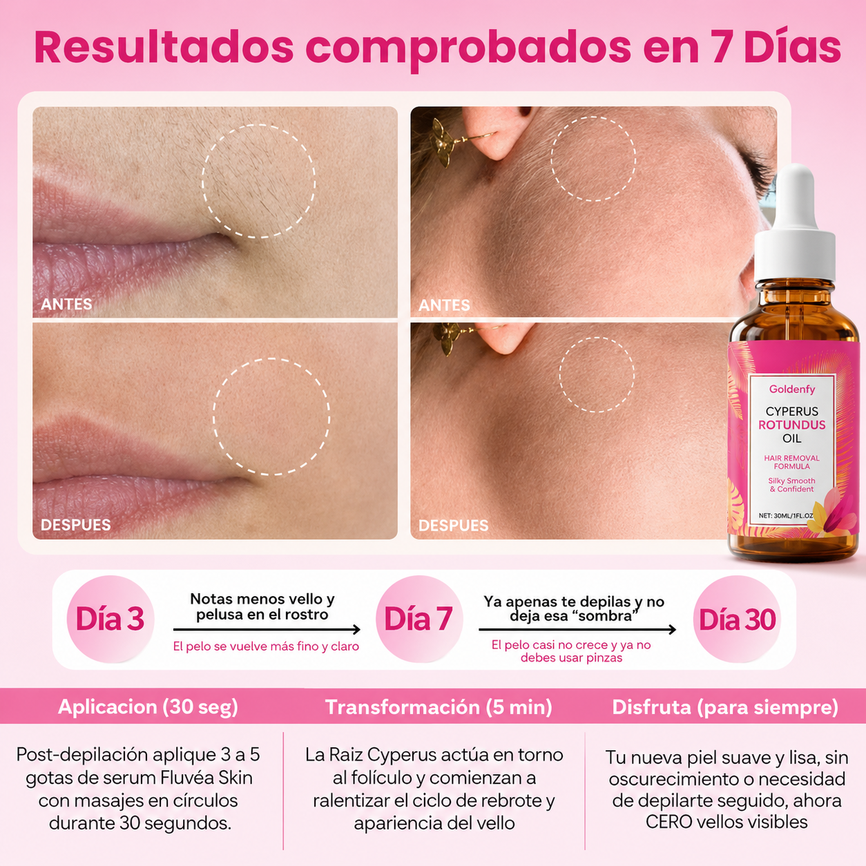 Cyperus Rotundus Oil 30 ml - Aceite Depilación Definitiva