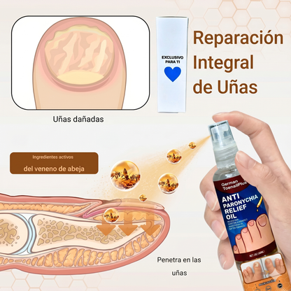 Super Promo 2x1 Spray Antihongos – Protección y cuidado para tus uñas
