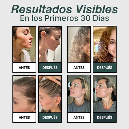HydraCare™ – Cabezal de Ducha con Filtro Anticloro La Solución Empieza en la Ducha, No en Cremas