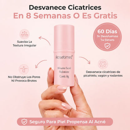 2x1 Rosetime™ - Stick Remodelador de Cicatrices de Acné