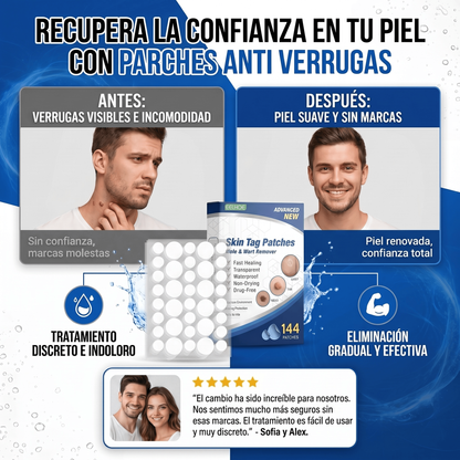 144 Parches Anti Verrugas – Tratamiento Discreto para Verrugas sin dolor