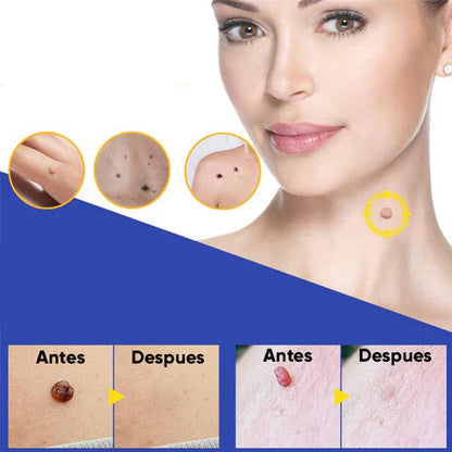 144 Parches Anti Verrugas – Tratamiento Discreto para Verrugas sin dolor